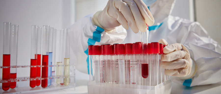 智慧医疗，智能试管架天线，RFID在医疗领域的应用